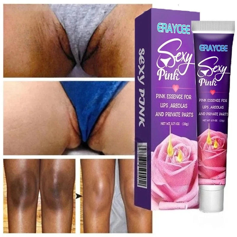 Brightening Cream For Intimate Parts Body Knees Remove Dull Pigments Brighten Serum Elbows Knuckles Lightening Skin Care