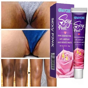 Brightening Cream For Intimate Parts Body Knees Remove Dull Pigments Brighten Serum Elbows Knuckles Lightening Skin Care