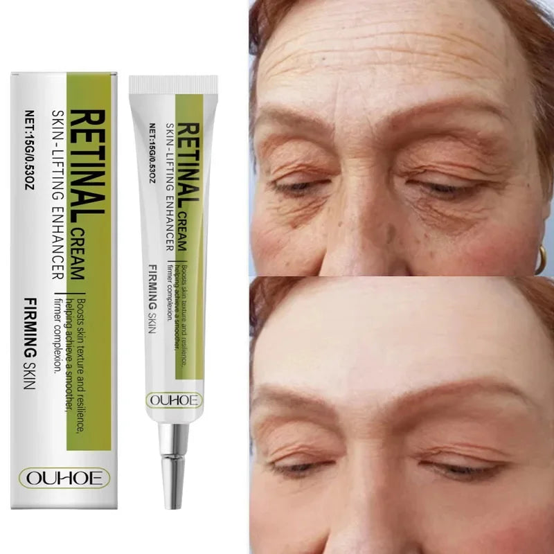 Retinol Cream Tightening Anti Wrinkle Improve Sagging Moisturizing Smoothing Lightening Firming Radiant Fine Lines Remov