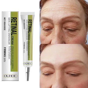 Retinol Cream Tightening Anti Wrinkle Improve Sagging Moisturizing Smoothing Lightening Firming Radiant Fine Lines Remov