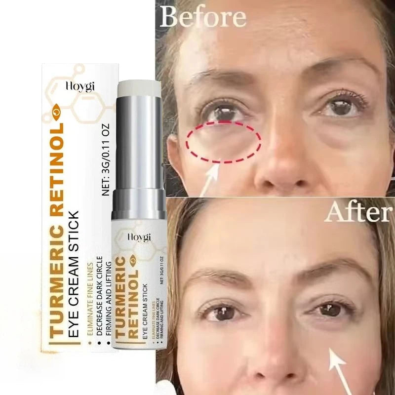 Instant Turmeric Eye Bag Removal Cream Hyaluronic Acid Anti-Wrinkle Firming Skin Fade Fine Lines Anti Dark Circle Puffin